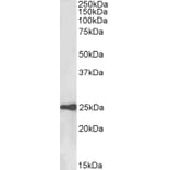 Western Blot - Anti-HE4 Antibody (A84804) - Antibodies.com