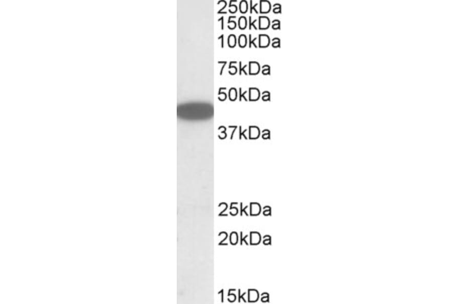 Western Blot - Anti-CXCR6 Antibody (A84805) - Antibodies.com