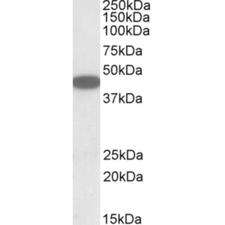 Western Blot - Anti-CXCR6 Antibody (A84805) - Antibodies.com