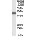 Western Blot - Anti-CXCR6 Antibody (A84805) - Antibodies.com