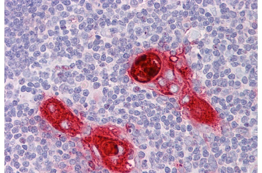 Immunohistochemistry - Anti-CXCR6 Antibody (A84805) - Antibodies.com