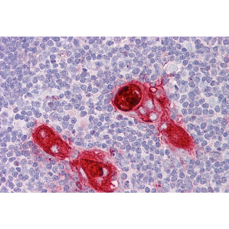 Immunohistochemistry - Anti-CXCR6 Antibody (A84805) - Antibodies.com
