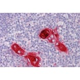 Immunohistochemistry - Anti-CXCR6 Antibody (A84805) - Antibodies.com