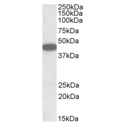 Western Blot - Anti-CXCR6 Antibody (A84805) - Antibodies.com