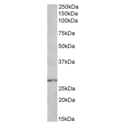 Western Blot - Anti-HOXB9 Antibody (A84806) - Antibodies.com