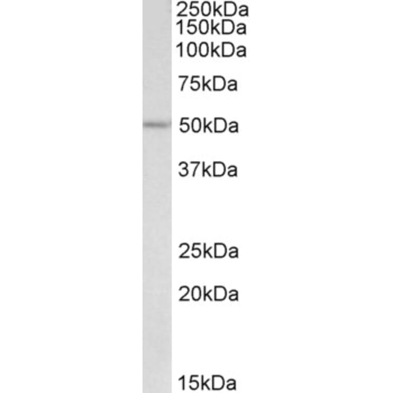 Western Blot - Anti-Skn1 Antibody (A84812) - Antibodies.com