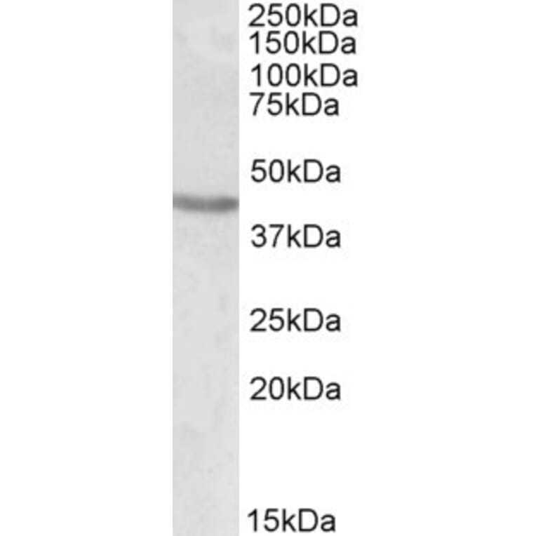 Western Blot - Anti-Brn-2 Antibody (A84813) - Antibodies.com