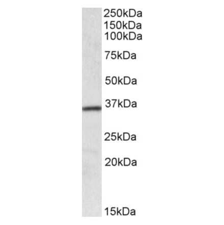 Western Blot - Anti-HOXA4 Antibody (A84817) - Antibodies.com