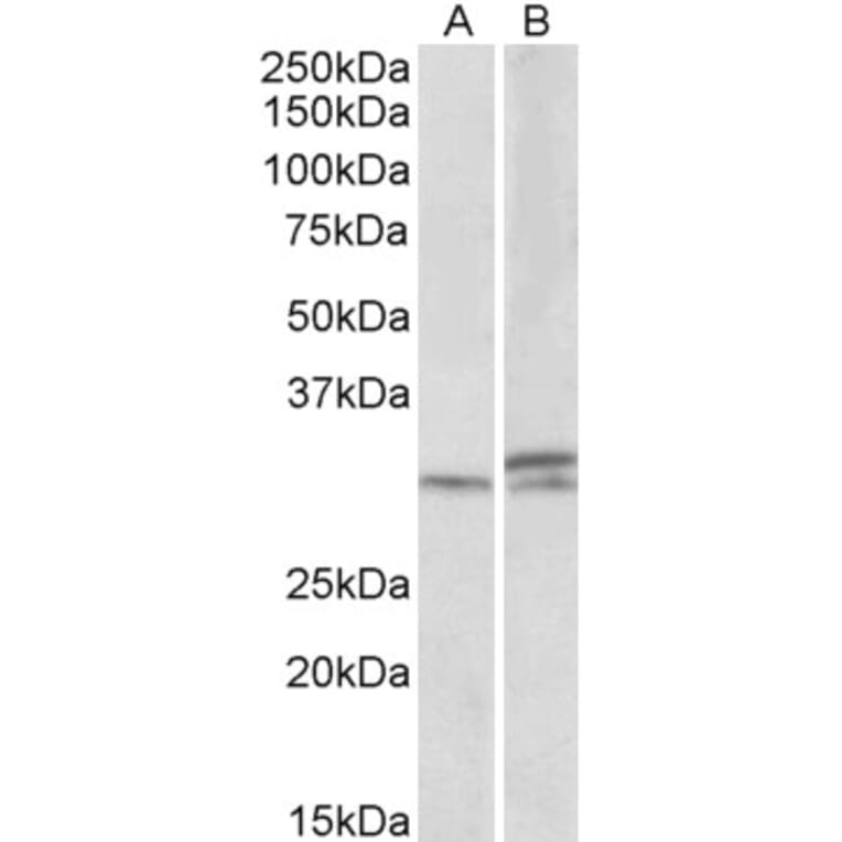 Western Blot - Anti-HOXA9 Antibody (A84819) - Antibodies.com