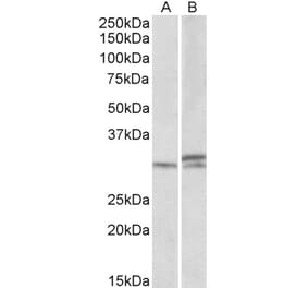 Western Blot - Anti-HOXA9 Antibody (A84819) - Antibodies.com