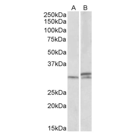 Western Blot - Anti-HOXA9 Antibody (A84819) - Antibodies.com