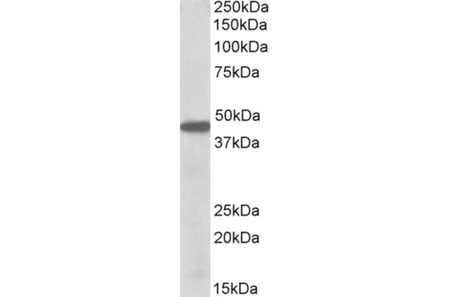 Western Blot - Anti-PBX1/PRL Antibody (A84820) - Antibodies.com