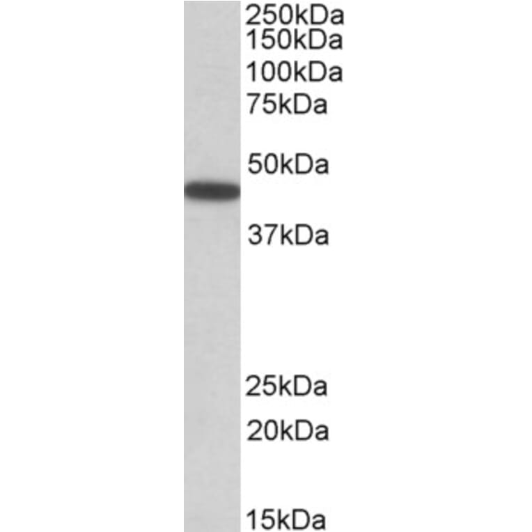 Western Blot - Anti-PBX1/PRL Antibody (A84820) - Antibodies.com