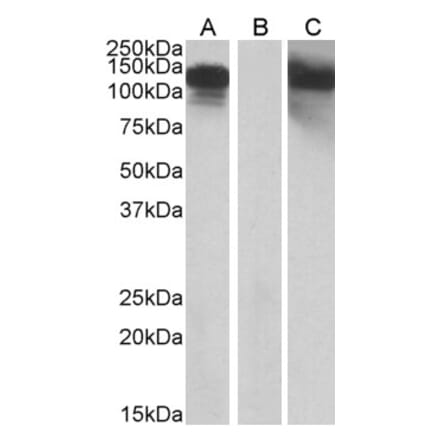 Western Blot - Anti-OB Cadherin Antibody (A84824) - Antibodies.com