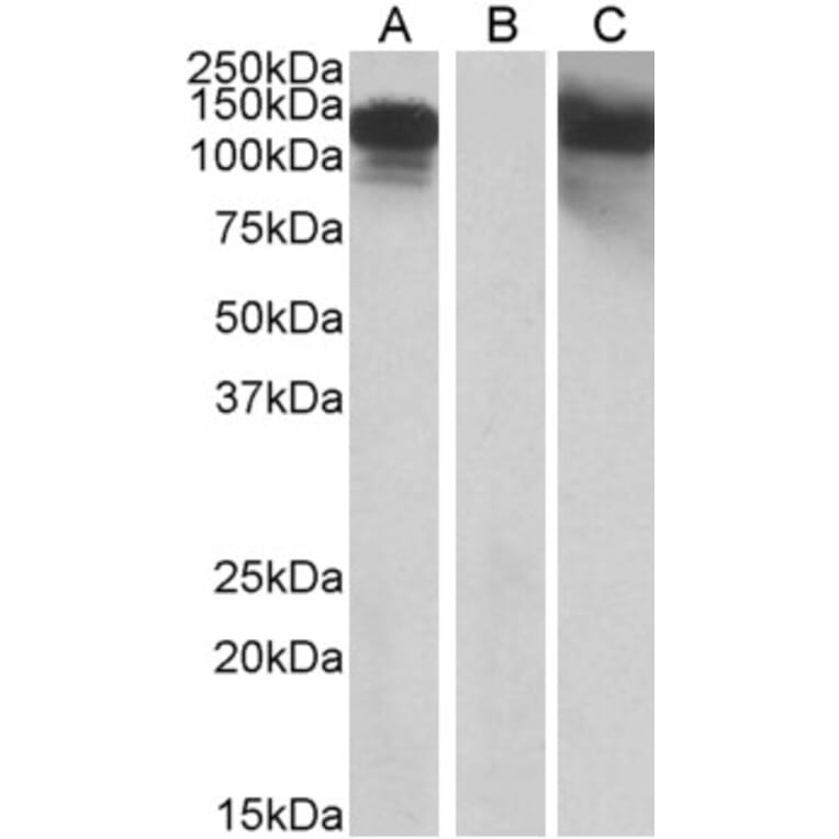 Western Blot - Anti-OB Cadherin Antibody (A84824) - Antibodies.com