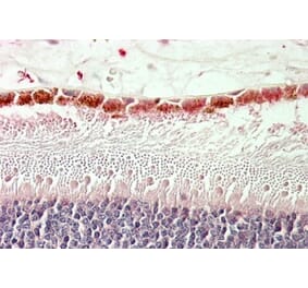 Immunohistochemistry - Anti-RDH5 Antibody (A84825) - Antibodies.com