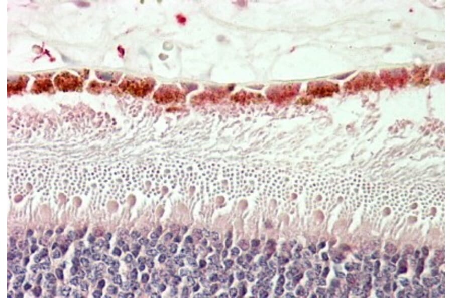 Immunohistochemistry - Anti-RDH5 Antibody (A84825) - Antibodies.com