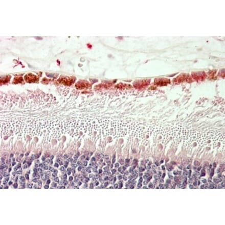 Immunohistochemistry - Anti-RDH5 Antibody (A84825) - Antibodies.com