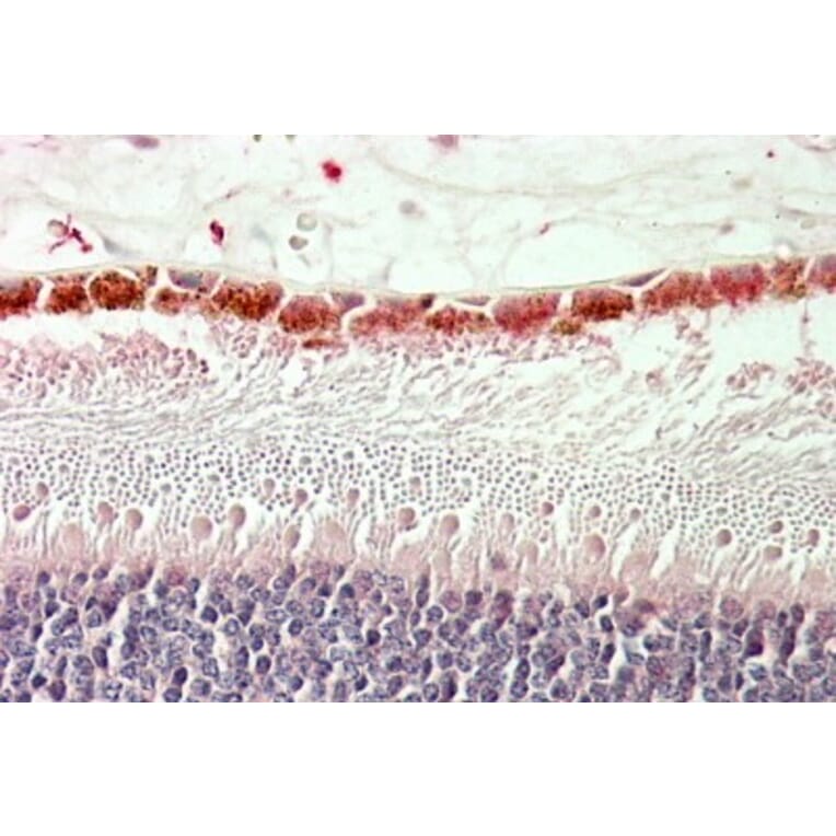 Immunohistochemistry - Anti-RDH5 Antibody (A84825) - Antibodies.com