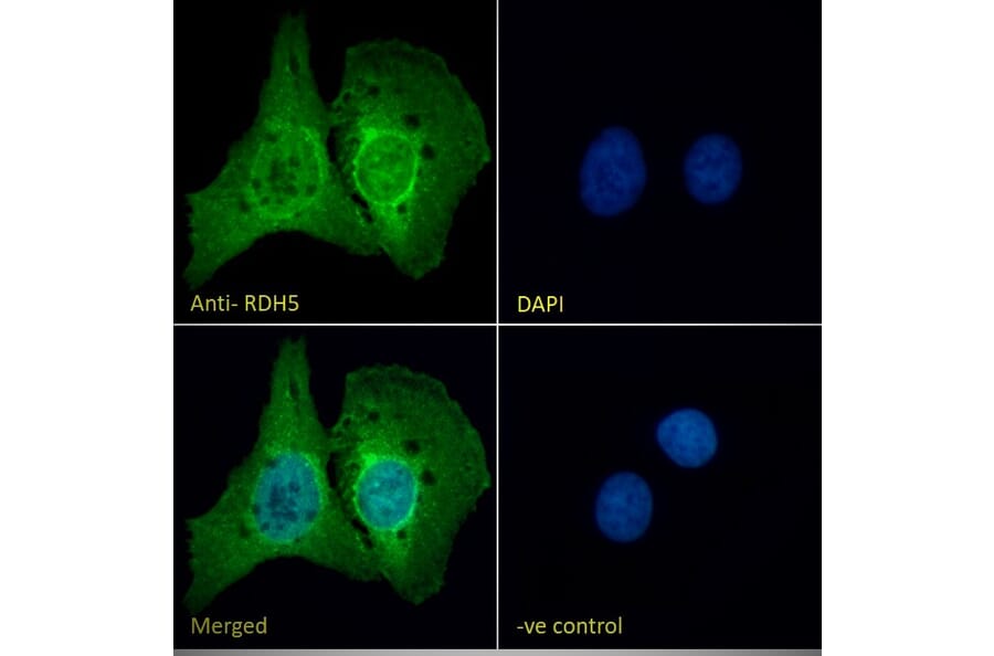 Immunofluorescence - Anti-RDH5 Antibody (A84825) - Antibodies.com