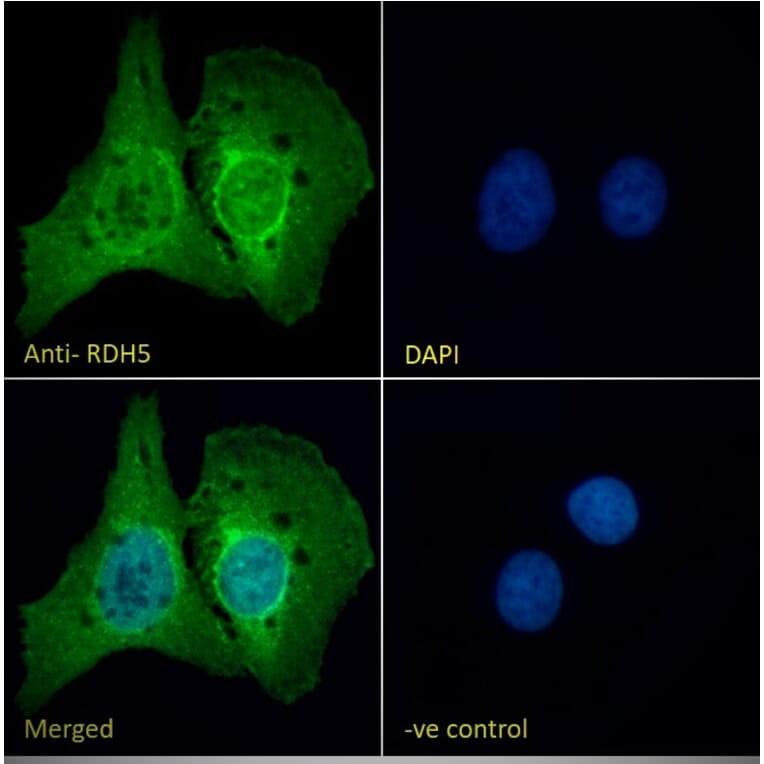 Immunofluorescence - Anti-RDH5 Antibody (A84825) - Antibodies.com