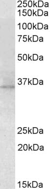 Anti-RDH5 Antibody (A84825) (2µg/ml) staining of Mouse Eye lysate (35µg protein in RIPA buffer). Primary incubation was 1 hour. Detected by chemiluminescence.