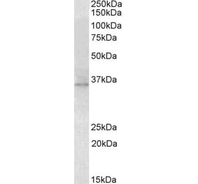 Western Blot - Anti-RDH5 Antibody (A84825) - Antibodies.com