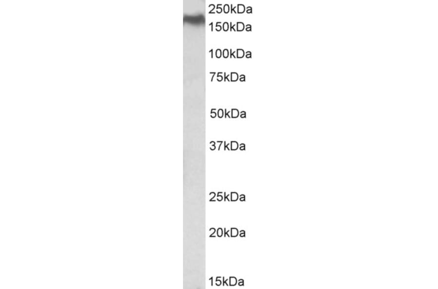 Western Blot - Anti-Niemann Pick C1 Antibody (A84827) - Antibodies.com