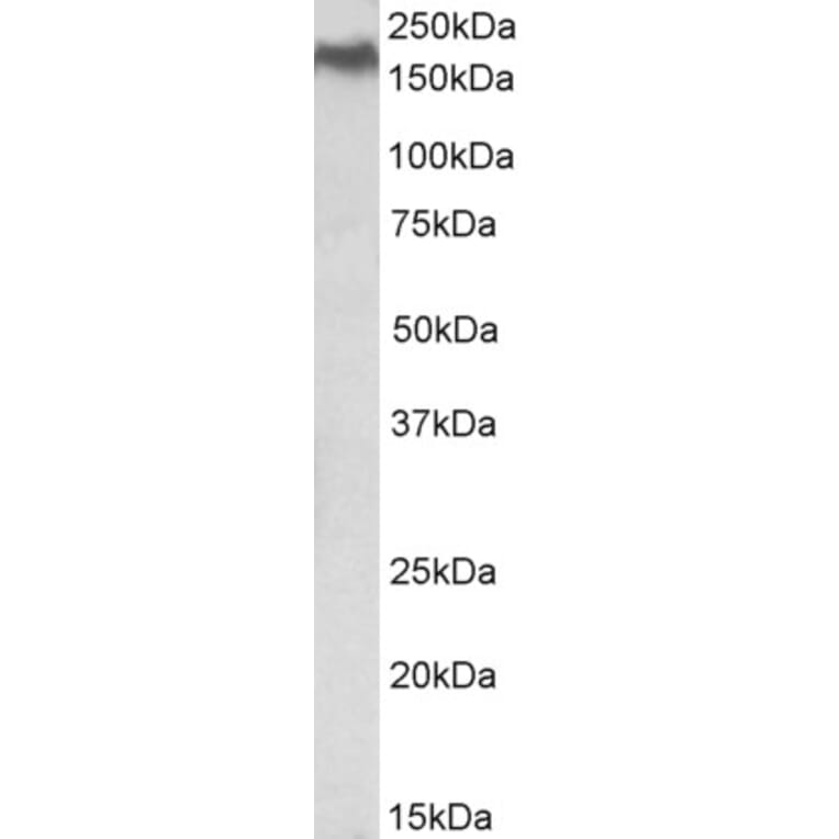 Western Blot - Anti-Niemann Pick C1 Antibody (A84827) - Antibodies.com