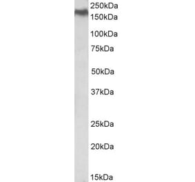 Western Blot - Anti-NPC1 Antibody (A84827) - Antibodies.com