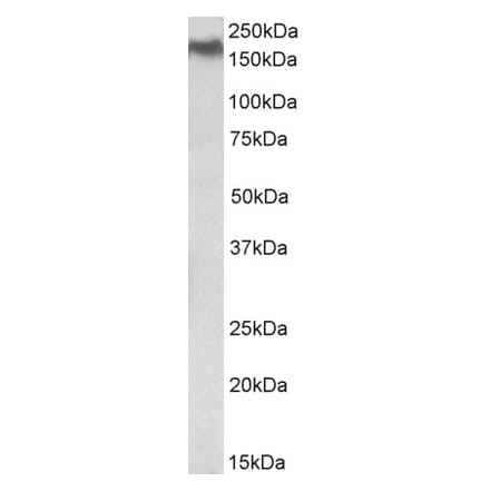 Western Blot - Anti-NPC1 Antibody (A84827) - Antibodies.com