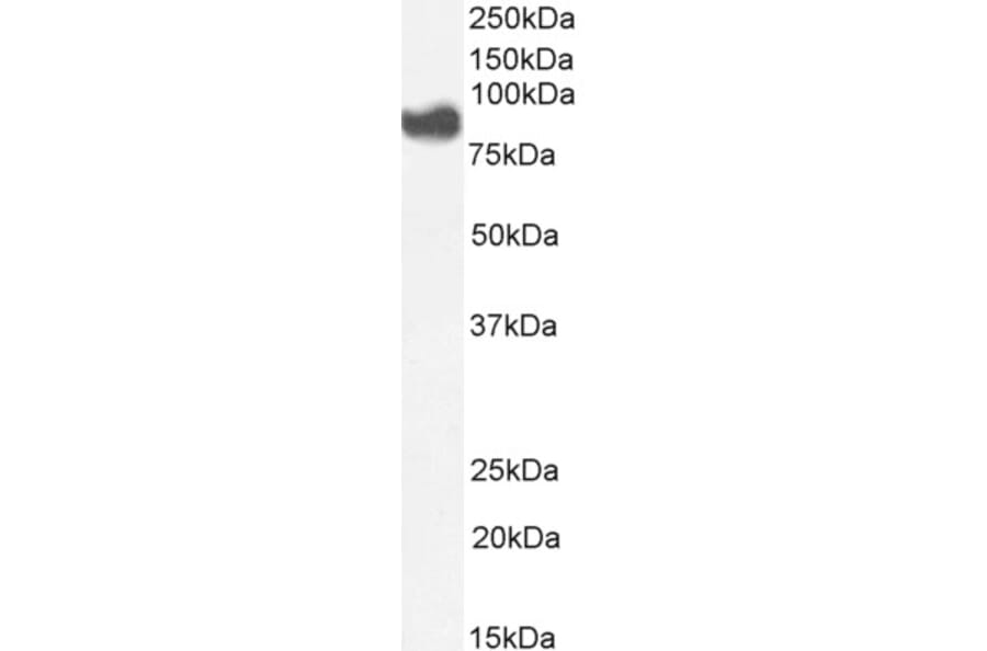 Western Blot - Anti-Cytosolic Phospholipase A2 Antibody (A84828) - Antibodies.com