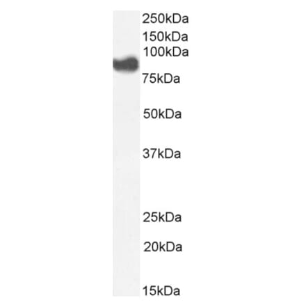 Western Blot - Anti-Cytosolic Phospholipase A2 Antibody (A84828) - Antibodies.com