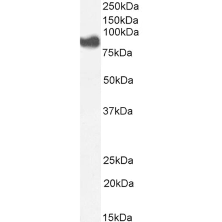 Western Blot - Anti-Cytosolic Phospholipase A2 Antibody (A84828) - Antibodies.com