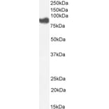 Western Blot - Anti-Cytosolic Phospholipase A2 Antibody (A84828) - Antibodies.com