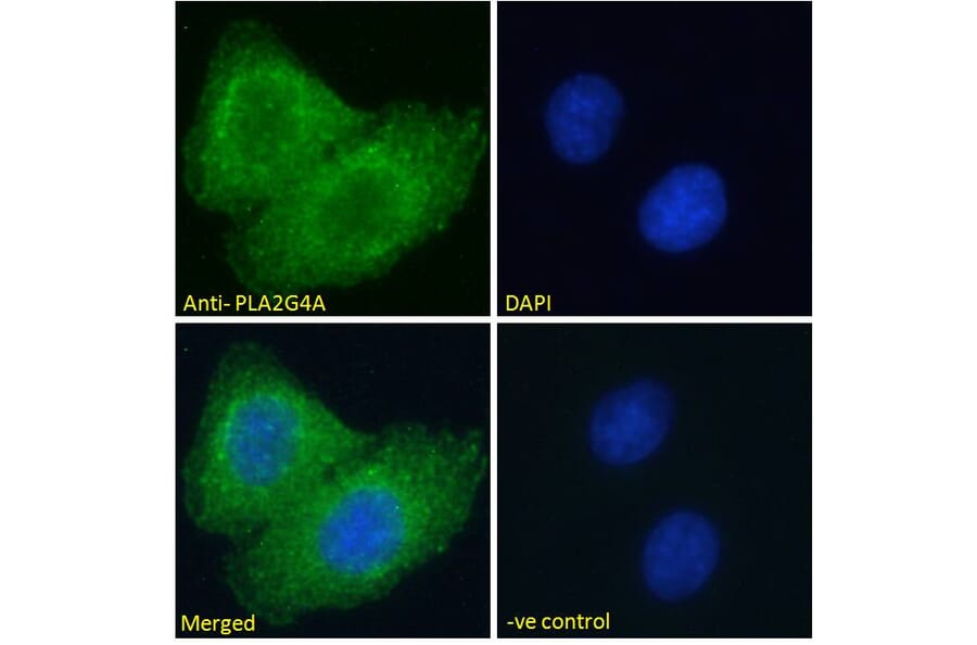Immunofluorescence - Anti-Cytosolic Phospholipase A2 Antibody (A84828) - Antibodies.com