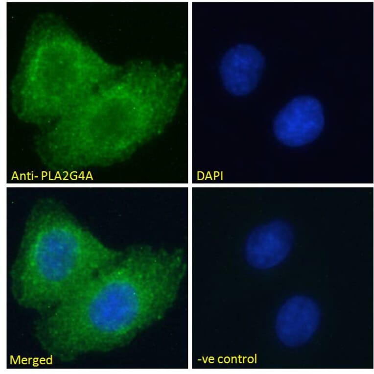 Immunofluorescence - Anti-Cytosolic Phospholipase A2 Antibody (A84828) - Antibodies.com