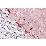 Immunohistochemistry - Anti-ALDH9A1 Antibody (A84830) - Antibodies.com
