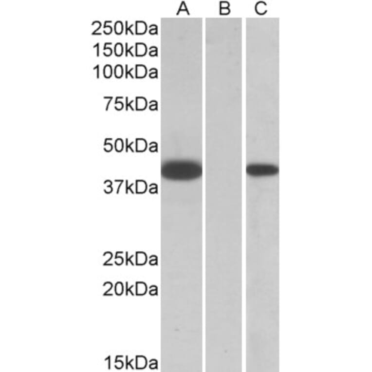 Western Blot - Anti-FANCF Antibody (A84832) - Antibodies.com