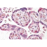 Immunohistochemistry - Anti-FANCE Antibody (A84833) - Antibodies.com