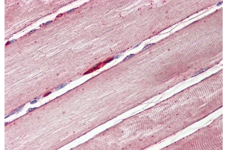 Immunohistochemistry - Anti-Glucose Transporter GLUT4 Antibody (A84834) - Antibodies.com