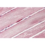 Immunohistochemistry - Anti-Glucose Transporter GLUT4 Antibody (A84834) - Antibodies.com