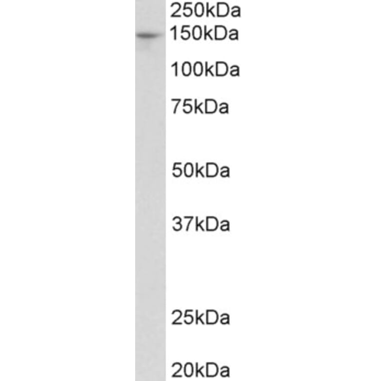 Western Blot - Anti-PEX1 Antibody (A84835) - Antibodies.com