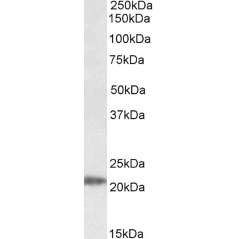 Western Blot - Anti-IMP3 Antibody (A84837) - Antibodies.com