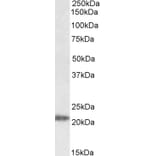 Western Blot - Anti-IMP3 Antibody (A84837) - Antibodies.com