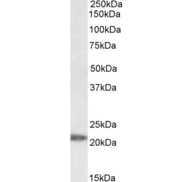 Western Blot - Anti-IMP3 Antibody (A84837) - Antibodies.com