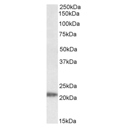 Western Blot - Anti-IMP3 Antibody (A84837) - Antibodies.com
