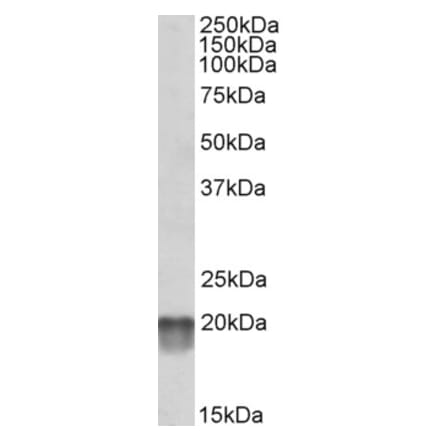 Western Blot - Anti-NDUFS7 Antibody (A84842) - Antibodies.com