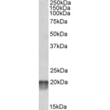 Western Blot - Anti-NDUFS7 Antibody (A84842) - Antibodies.com