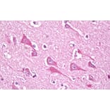 Immunohistochemistry - Anti-NDUFS7 Antibody (A84842) - Antibodies.com